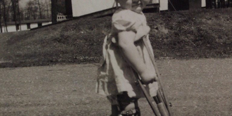 Child with Polio Using Crutches